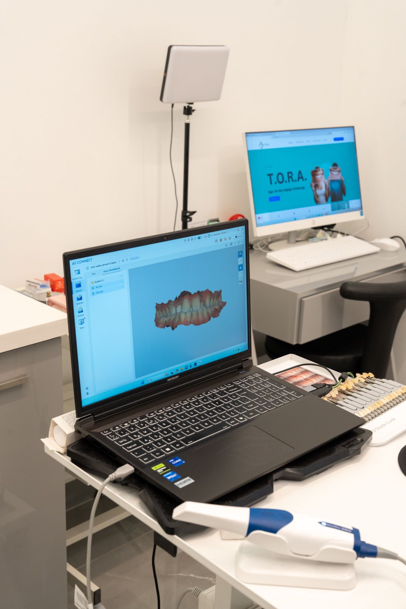 A laptop showing a digital dental model on a workstation.