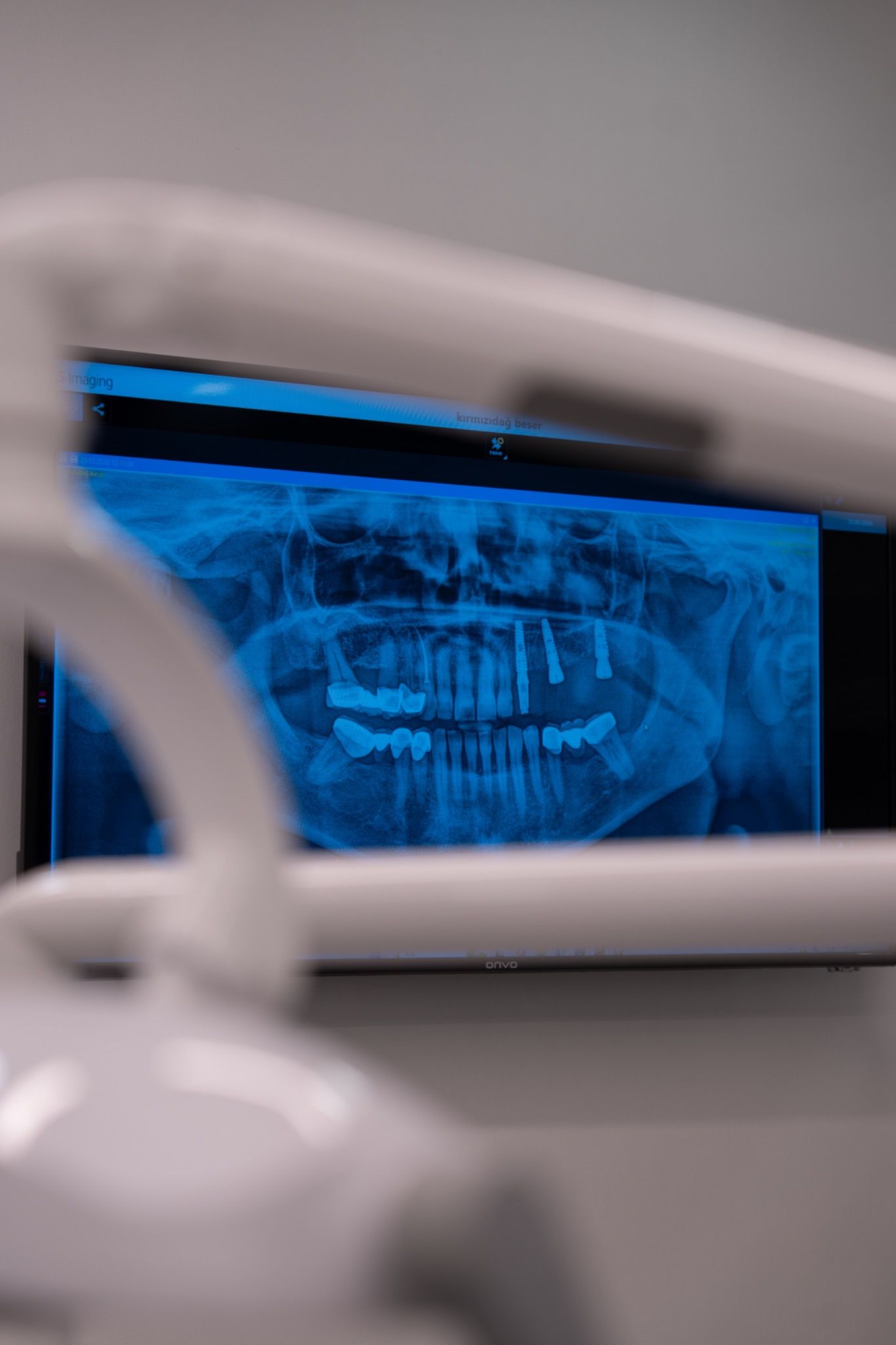 Dental imaging on a screen in the clinic.